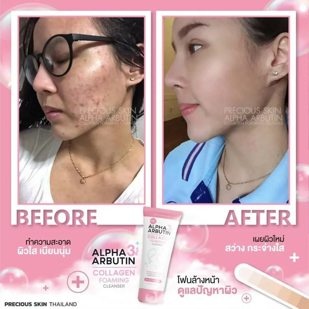 Precious Skin Thailand Alpha Arbutin 3    Collagen Foaming Face Cleanser/Sabun Wajah/Foaming 120ml