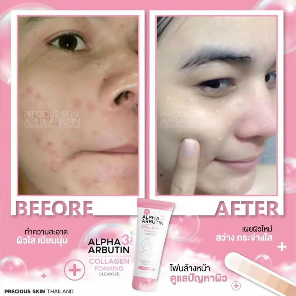 Precious Skin Thailand Alpha Arbutin 3    Collagen Foaming Face Cleanser/Sabun Wajah/Foaming 120ml